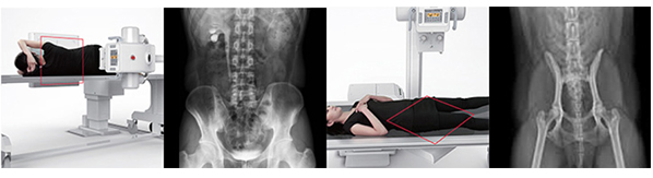 X-RAY 장비